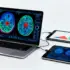 Federated Learning Breakthrough: Smarter Client Selection Boosts Brain Tumor Detection